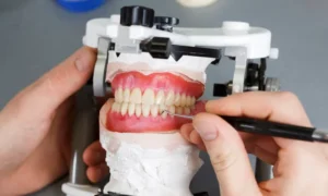 nieuwe prothese, kunstgebit, nieuwegein, roder